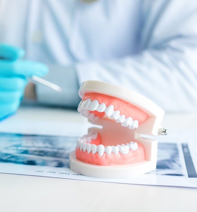 dentures-in-simon-fraser-dental-centre