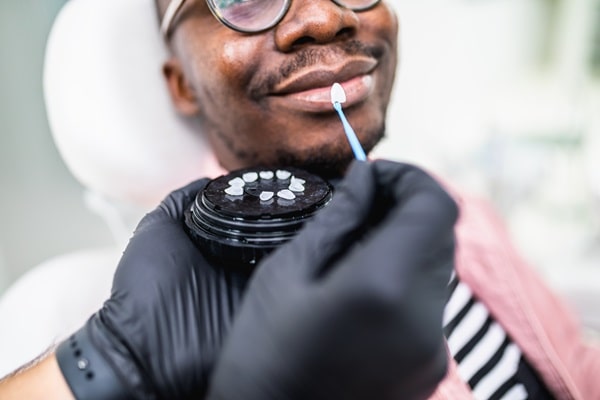 lumineers-simon-fraser-dental-centre