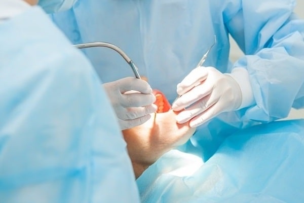 oral-surgery-simon-fraser-dental-centre
