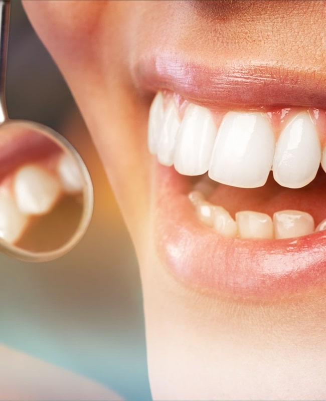 periodontics-in-simon-fraser-dental-centre